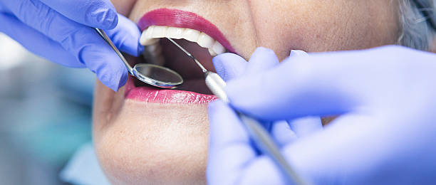 Best Broken or Cracked Tooth Emergency Dentist in Hauser, ID